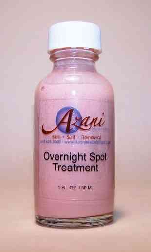 best overnight spot treatment